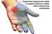 Туннельный синдром и упражнения для кистей рук